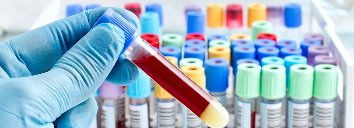 Hand of a lab technician holding blood tube